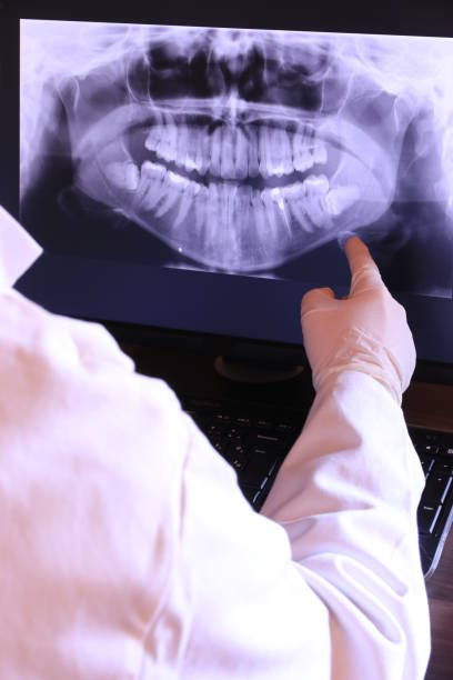 Best Emergency Denture Repair in Wernersville, PA